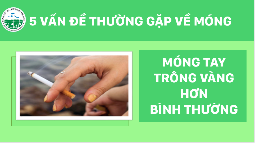 5-van-de-thuong-gap-ve-mong-2-logo