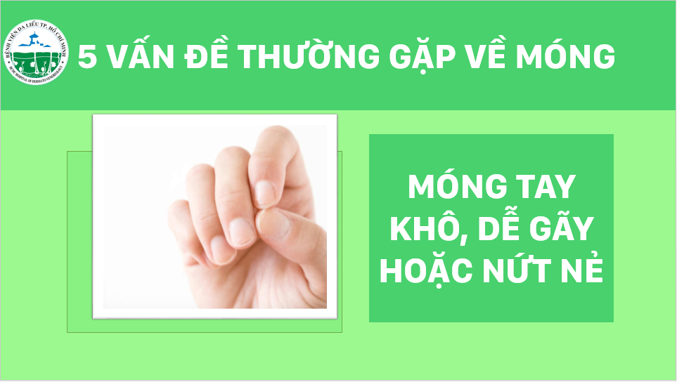 5-van-de-thuong-gap-ve-mong-4-logo