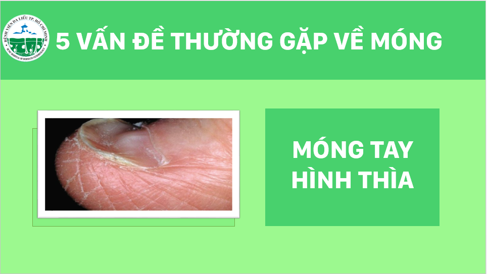 5-van-de-thuong-gap-ve-mong-5-logo