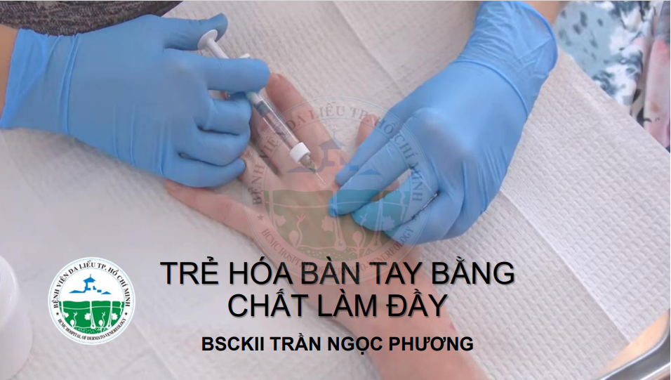 BVDL-TRE-HOA-BAN-TAY-BANG-CHAT-LAM-DAY-BS-NGOC-PHUONG