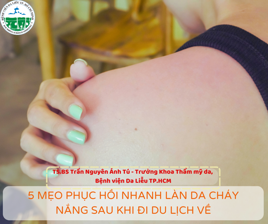 bvdl-phuc-hoi-da-chay-nang-sau-khi-du-lich-ve-bs-tu