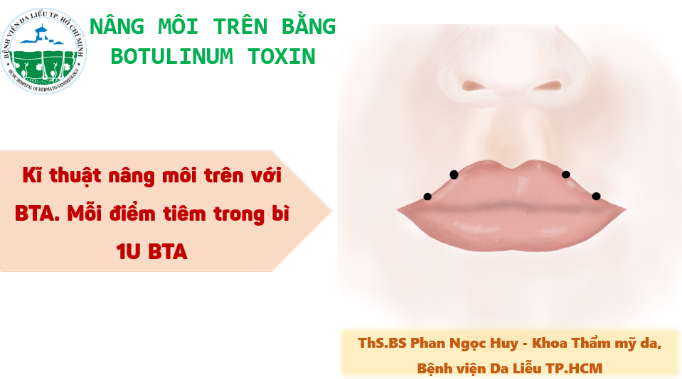 nang-moi-tren-bang-botox-1-up