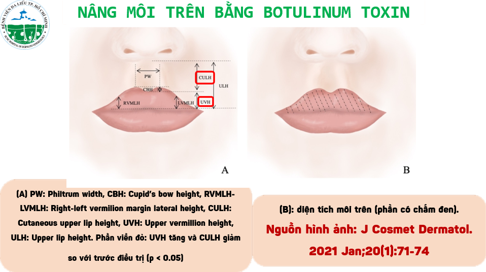 nang-moi-tren-bang-botox-2-up