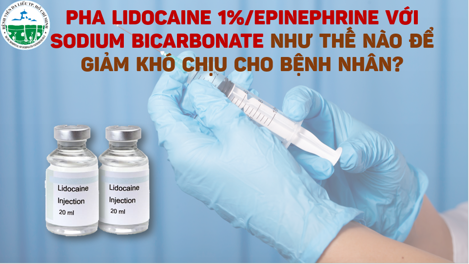 pha-lidocaine-giam-kho-chiu
